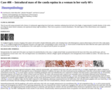 Pathology Case Study: Intradural mass of the cauda equina in a woman in her early 60's