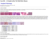 Pathology Case Study: A female in her 70s with pelvic masses