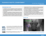 OER-UCLouvain: Planning d'une prothèse totale de la hanche (PTH) : consentement