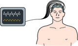 Video: 2-Minute Neuroscience: Electroencephalography (EEG)