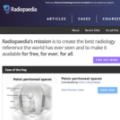 Radiopaedia: The Peer-Reviewed Collaborative Radiology Resource