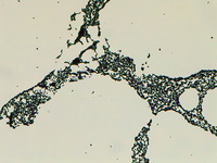 p000021 Calbicans broth Gram stain 100x v001