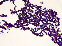 p000022 Calbicans broth Gram stain 400x v1