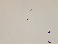 p000023 Calbicans broth Gram stain 400x v2