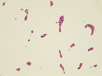 p000030 Nsicca Gram Stain 1000x