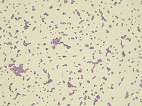 p000031 Coccus Gram stain 1000x