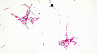 p000061 Bcereus endospore stain 1000X