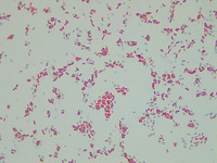 p000063 Bsubtilis 48h endospore 1000x