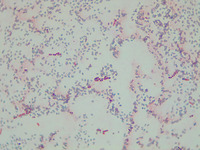p000064 Bsubtilis 5d endospore 1000x