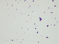 p000176 Llactis agar Gram stain 1000x