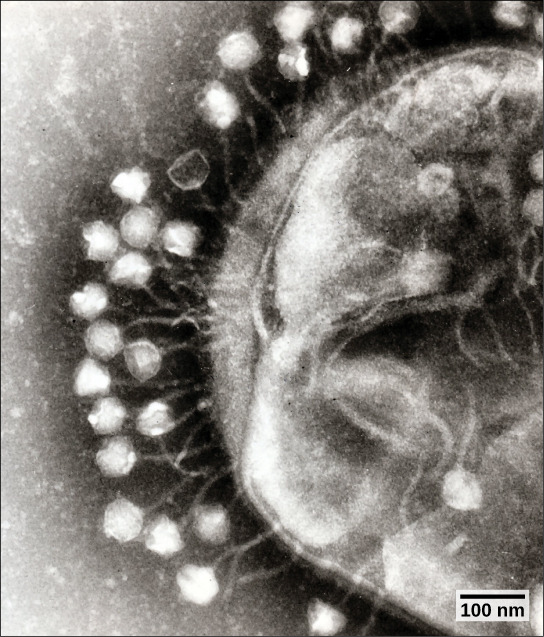 Virus Infections and Hosts