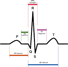 ECG