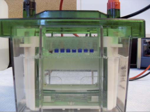 Protein Electrophoresis