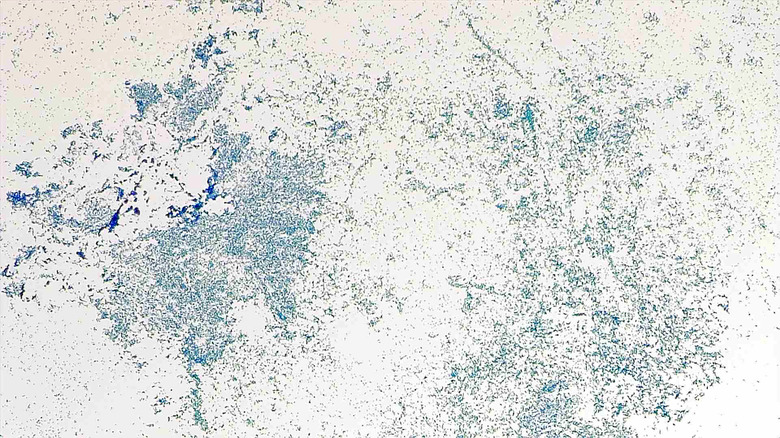 Micrograph Escherichia coli methylene blue 100x p000003