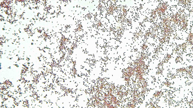 Micrograph Escherichia coli safranin red 400x p000005
