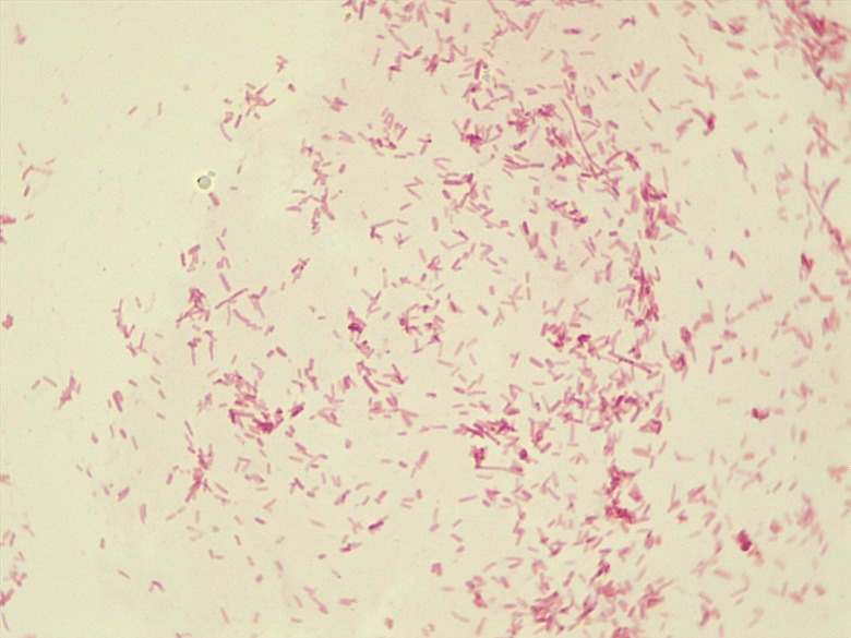Micrograph Escherichia coli Gram stain 1000x p000007