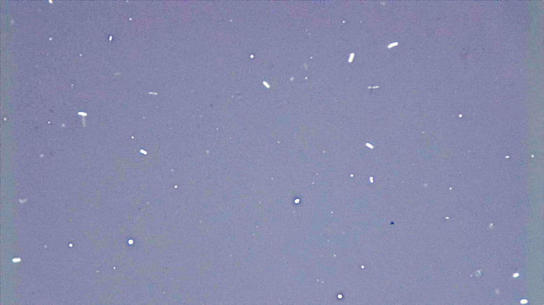 Micrograph Escherichia coli nigrosin negative stain 1000x p000015