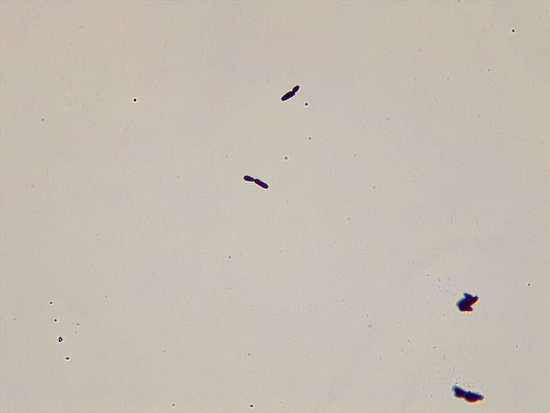Micrograph Candida albicans Gram stain 400x p000023
