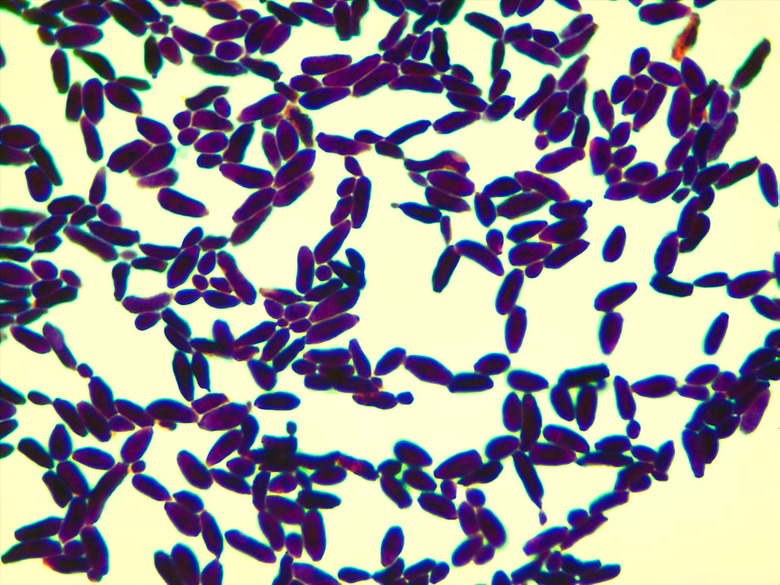 Micrograph Candida albicans Gram stain 1000x p000024