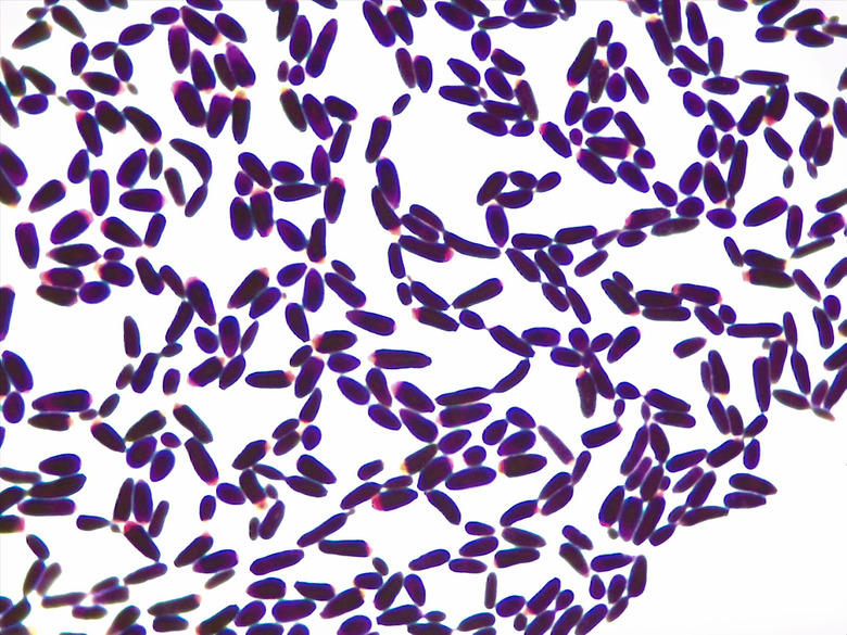 Micrograph Candida albicans Gram stain 1000x p000027