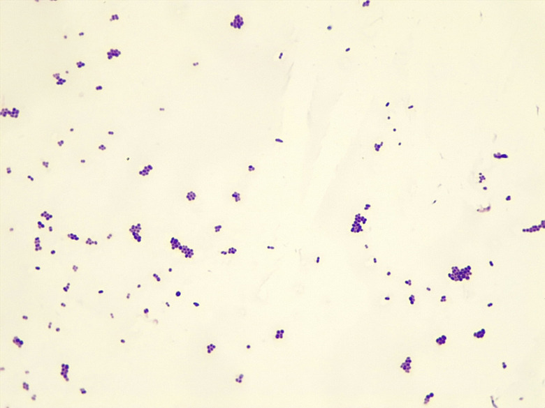 Staphylococcus aureus seen under microscope after Gram's staining