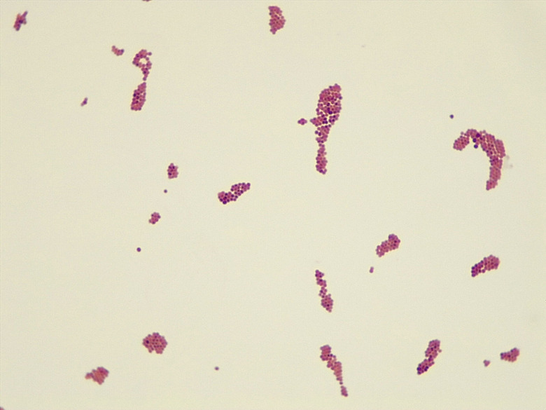 Micrograph Neisseria sicca Gram stain 1000x p000030