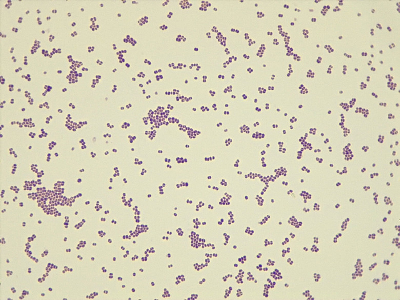Micrograph Coccus Gram stain 1000x p000031