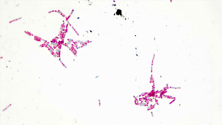 Micrograph Bacillus cereus 48 h endospore 1000X p000061