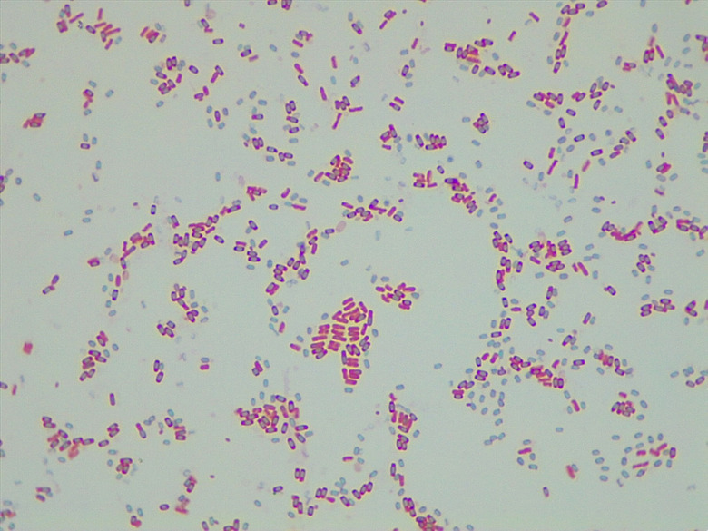 Micrograph Bacillus subtilis 48h endospore 1000X p000063