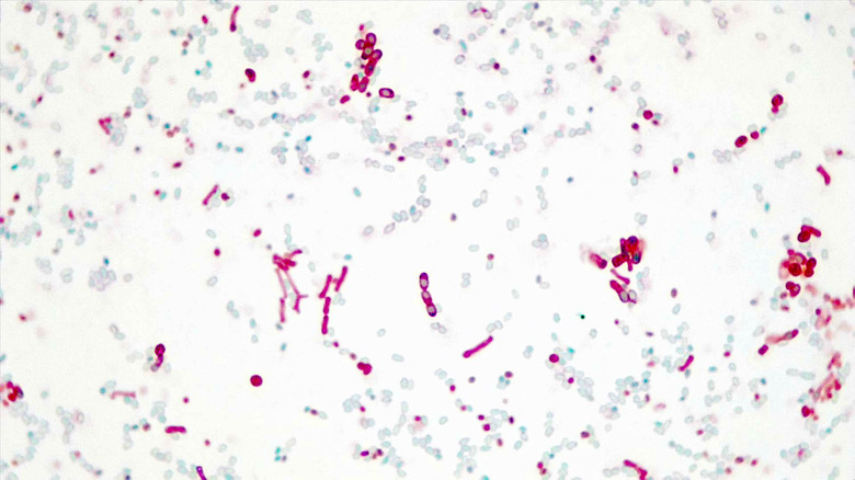 Micrograph Bacillus megaterium 5d endospore 1000X p000066