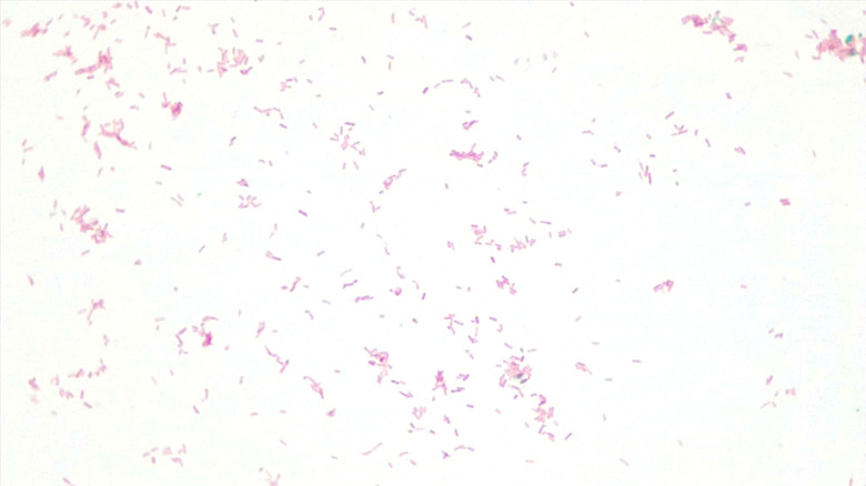 Micrograph Escherichia coli 5d endospore 1000X p000068