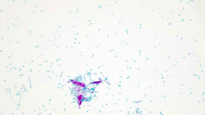 Micrograph Escherichia coli and Mycobacterium smegmatis acid fast 1000X p000069