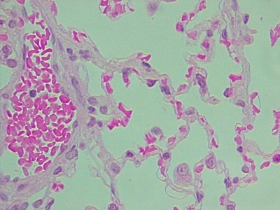 simple squamous epi_with RBCs in capillary_lung alveoli_630x, p000121