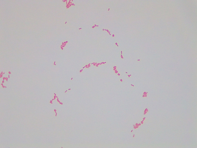Micrograph Enterobacter aerogenes gram stain 1000X p000175