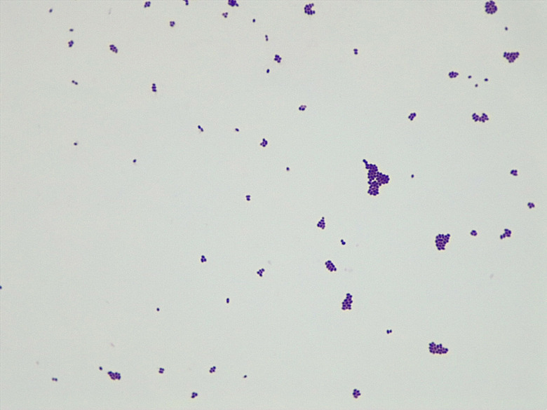 Micrograph Lactococcus lactis gram stain 1000X p000176