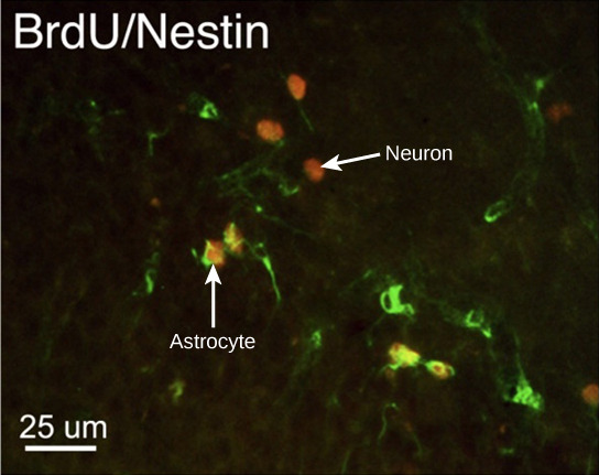 Neurons and Glial Cells